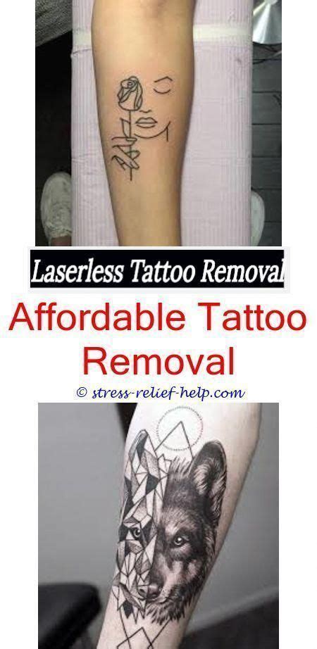 The revlite si can improve the skin complexion safely, quickly and effectively. Pin on How To Remove a Tattoo