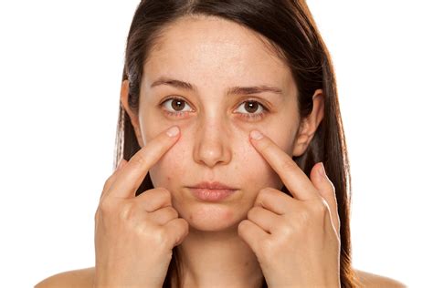 How To Remove Dark Circles Under Eyes Tips And Home Remedies