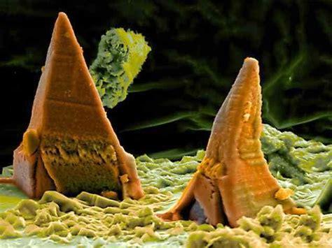 21 Photos Of The Amazing And Bizarre World Under A Microscope