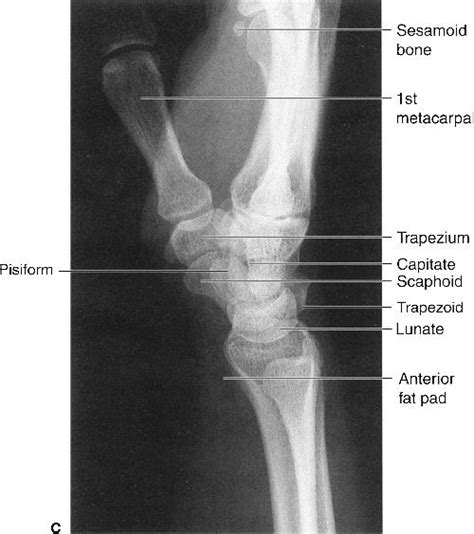 Musculoskeletal System Radiology Key