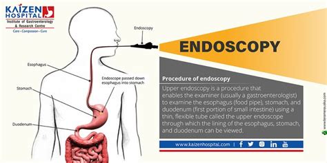 Upper Gi Endoscopy Procedure