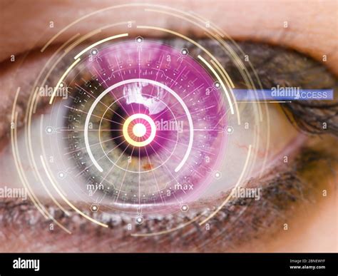 The Concept Of Sensor Implanted Into Human Eye Stock Photo Alamy