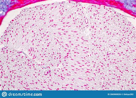Characteristics Tissue Of Olfactory Epithelium Human Under The