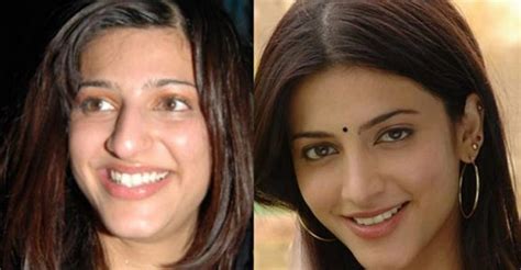 Check Out How Plastic Surgery Transformed These Actresses