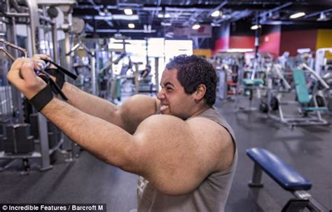 Island News The Real Life Popeye Who Has The Worlds Biggest Biceps