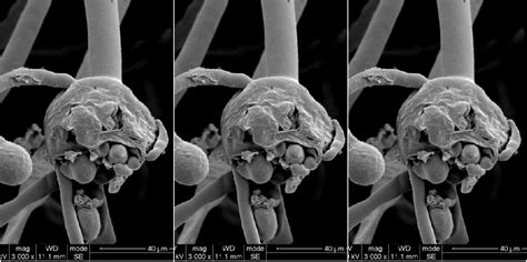 Black fungus may refer to: Black Fungus Declared an Epidemic in Rajasthan - The Wire ...