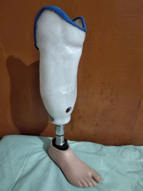 Carbon Fiber Below Knee Prosthesis With Silicon Liner And Shuttle Lock