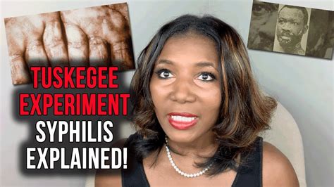 Tuskegee Syphilis Experiment Syphilis Explained