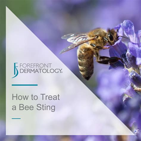 How To Treat A Bee Sting Forefront Dermatology