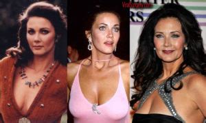 Lynda Carter Plastic Surgery Before And After Facelift Pictures