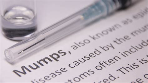 13 Cases Of Mumps Now Confirmed At Suny New Paltz Fox News