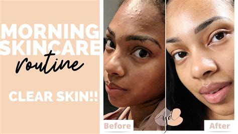 The ordinary moisturizing factors (7$), this one is a great simple especially great for those with sensitive skin. Morning Skincare Routine | FUNGAL ACNE SAFE (GIVEAWAY ...
