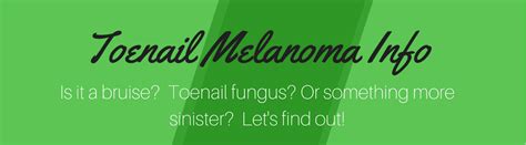 Melanoma can occur anywhere on the skin, even in areas of the body not exposed to the sun. How to Tell If You Have a Toenail Melanoma