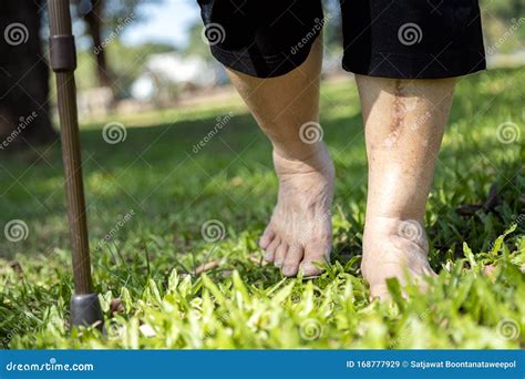 Closeup Of Barefoot Feetasian Senior Woman Walking Barefoot On Grass