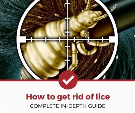 Looking For Ways To Get Rid Of Lice Fast We Ve Got You Covered With An
