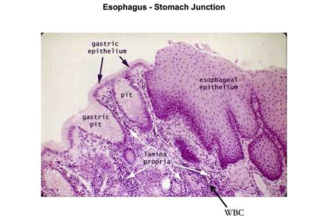 Esophagus Stomach Epithelial Junction Histology Medical School