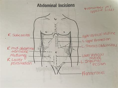 Abdominal Incisions Diagram Quizlet
