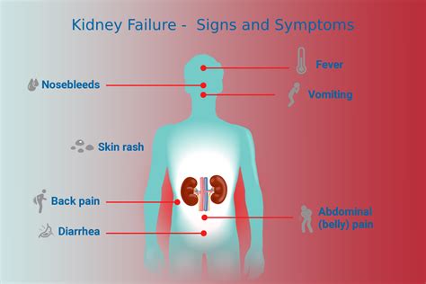 Signs And Symptoms Of Kidney Failure Ayurvedic Kidney Failure Treatment