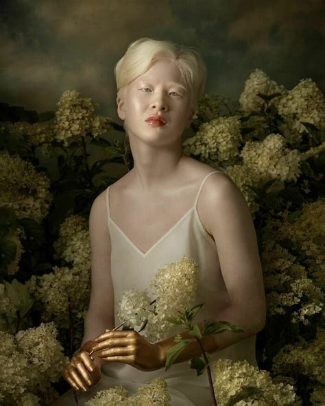 Albino Girl Gets Abandoned As A Baby Grows Up To Become A Vogue Model