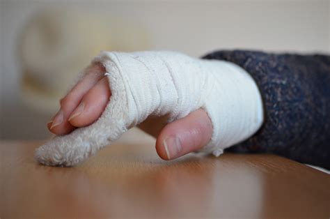 5 Signs Of A Broken Hand And What You Should Do About It