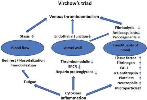 Virchow S Node