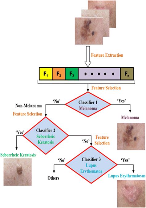 Flowchart For Classification Of Three Skin Diseases Download