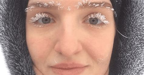 Peoples Eyelashes Are Freezing Together In Russia