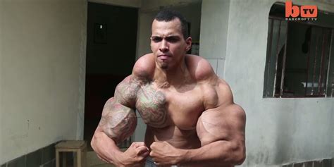 Guy Who Wanted To Be A Real Life Hulk Almost Had To Have Arms Amputated Huffpost