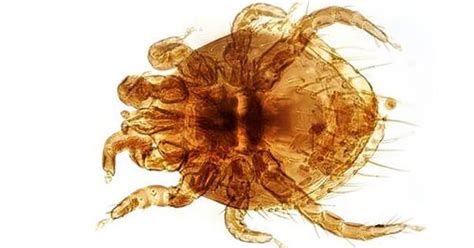 67 Amazing What Mites Can Live On Humans Insectza