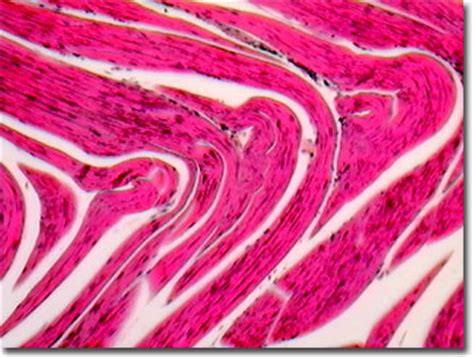These muscle cells are long and multinucleated. Molecular Expressions: Science, Optics & You - Olympus MIC ...