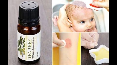 7 Ways To Use Tea Tree Oil For Fungal Infections Ringworm Jock Itch