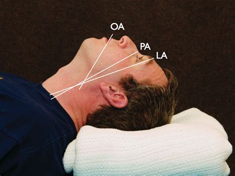 10 Tips For Effective Airway Management And Ventilation