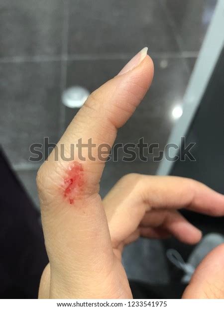 Wound Knife Cut Finger Stock Photo 1233541975 Shutterstock