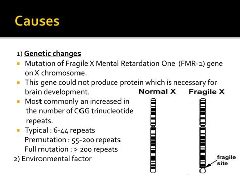 Ppt Fragile X Syndrome Fxs Powerpoint Presentation Free Download Id2272314