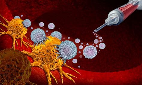 Prostate Cancer Immunotherapy Alone Is Not Enough Renal And Urology News