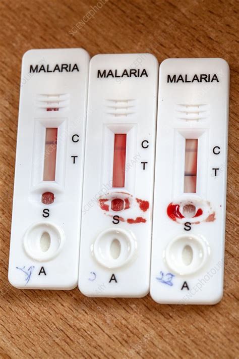All measurements based on pcr testing should come to an end asap Malaria rapid diagnostic test strips - Stock Image - C037 ...