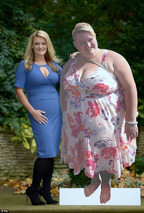 Silliming World Mother Sheds 14 Stone After Shunning Gastric Band