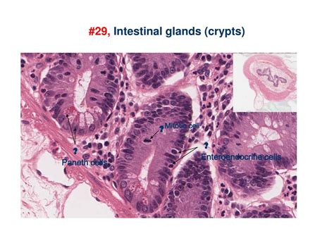 Ppt Gi Sequence Histology Powerpoint Presentation Free Download