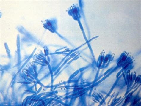 Which of the following would be virtually indistinguishable under the microscope? BIO 182 Lab: Final Practical Flashcards - Biological ...