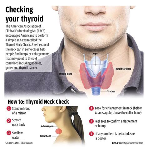 See This Diagram To Learn How To Check Yourself For Thyroid Dysfunctions Thyroid Issues