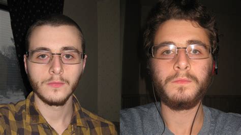 8 minoxidil beard before and afters. Minoxidil beard reddit shave - BeardStylesHQ