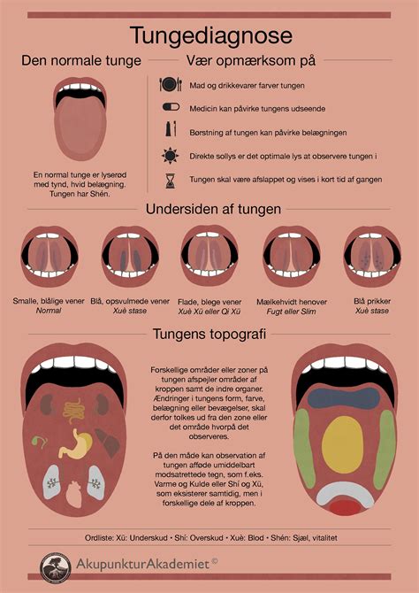 Tongue Diagnosis Chart Clinical Charts And Supplies