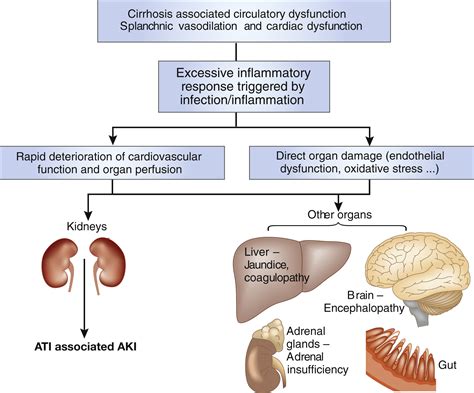 Acute Kidney Injury In Acute On Chronic Liver Failure Where Does