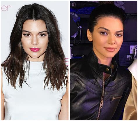 Kendall Jenner Before And After What Shes Said About Plastic Surgery