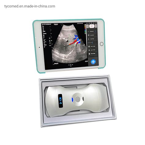 3 In 1 Convexandphasedlineartransvaginal Wireless Medical Portable