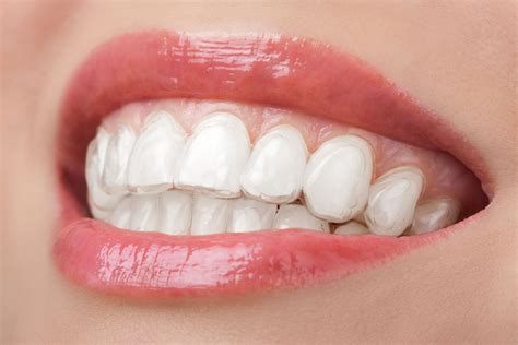 Teeth Whitening Chewing Gums Really Work The Houston Dentists