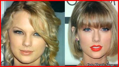 Taylor Swift Plastic Surgery Celebrities Plastic Surgery