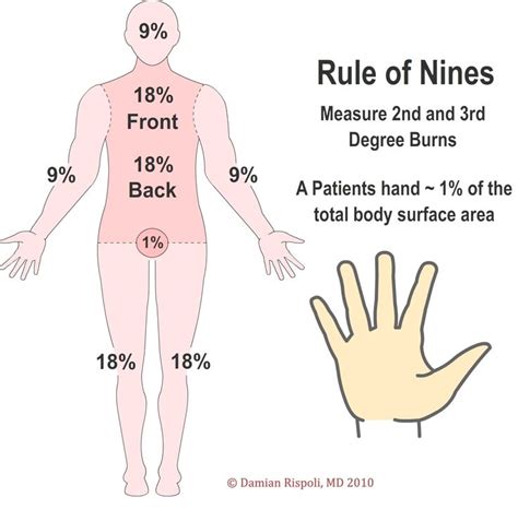 First Aid Skill Package Level 1 Rule Of Nines Nurse Study Notes