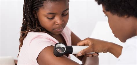 Misdiagnosis Is Common For Black Dermatology Patients Real Health