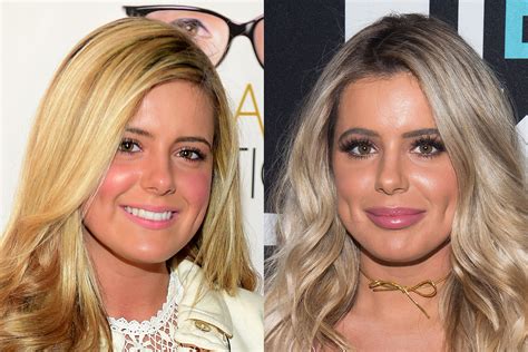 Brielle Biermann Shares Before And After Pics Of Her Beauty Transformation